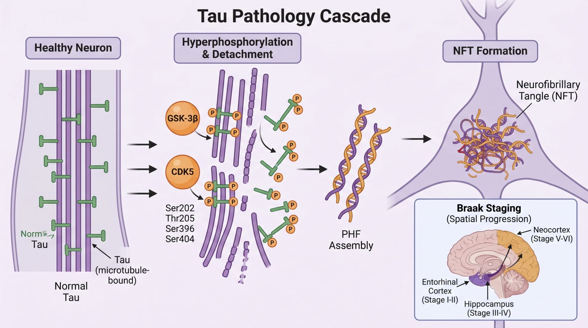 GSK-3-beta와 CDK5에 의한 Ser202, Thr205, Ser396, Ser404의 Tau hyperphosphorylation, paired helical filaments와 intracellular NFTs 형성 (SciFig로 생성한 이미지)
